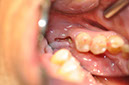 %_tempFileNameImplant%2079a4%20%