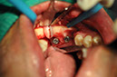 %_tempFileNameImplant%2079b1%