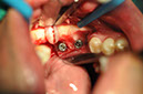 %_tempFileNameImplant%2079b2%