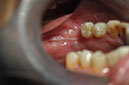 %_tempFileNameImplant%2079b22%
