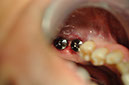 %_tempFileNameImplant%2079b23%