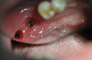 %_tempFileNameImplant%2079b24%