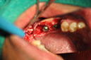 %_tempFileNameImplant%2079b3%