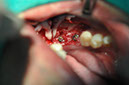 %_tempFileNameImplant%2079b5%