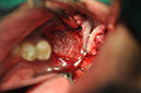 %_tempFileNameImplant%2079b8%