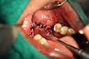 %_tempFileNameImplant%2079b9%20%