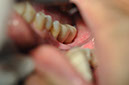 %_tempFileNameImplant%2079c1%
