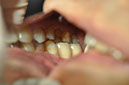 %_tempFileNameImplant%2079c2%