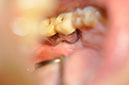 %_tempFileNameImplant%2079c3%