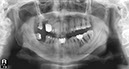 %_tempFileNameImplant%2079d1%