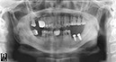 %_tempFileNameImplant%2079d2-1%