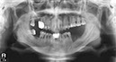 %_tempFileNameImplant%2079d2%