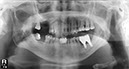 %_tempFileNameImplant%2079d3%