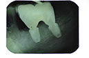 %_tempFileNameImplant%2079d4%