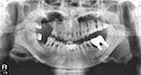 %_tempFileNameImplant%2079d6%