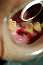 %_tempFileNameImplant%207a3%