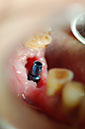 %_tempFileNameImplant%207a4%