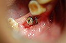 %_tempFileNameImplant%207a5%