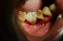 %_tempFileNameImplant%207a6%
