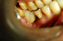 %_tempFileNameImplant%207a7%