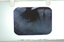 %_tempFileNameImplant%207b1%