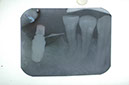 %_tempFileNameImplant%207b3%