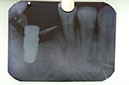 %_tempFileNameImplant%207b5%