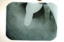 %_tempFileNameImplant%207b6%