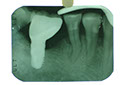 %_tempFileNameImplant%207b7%