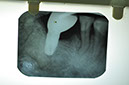 %_tempFileNameImplant%207b8%