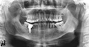 %_tempFileNameImplant%207c1%