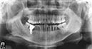 %_tempFileNameImplant%207c2%