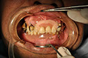 %_tempFileNameImplant%2080a1%