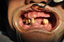 %_tempFileNameImplant%2080a2%