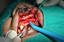 %_tempFileNameImplant%2080b1%