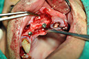 %_tempFileNameImplant%2080b4%