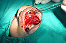 %_tempFileNameImplant%2080b6%