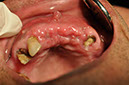 %_tempFileNameImplant%2080b7%