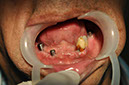 %_tempFileNameImplant%2080c1%