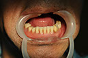 %_tempFileNameImplant%2080c2%