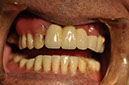 %_tempFileNameImplant%2080c8%