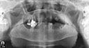 %_tempFileNameImplant%2080d1%