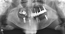 %_tempFileNameImplant%2080d2%