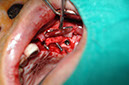%_tempFileNameImplant%2083b1%