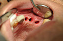 %_tempFileNameImplant%2083c1%