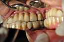 %_tempFileNameImplant%2083c2%