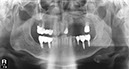%_tempFileNameImplant%2083d1%