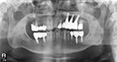 %_tempFileNameImplant%2083d2%