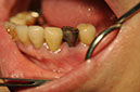 %_tempFileNameImplant%2085a1%