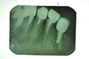%_tempFileNameImplant%2085a2%